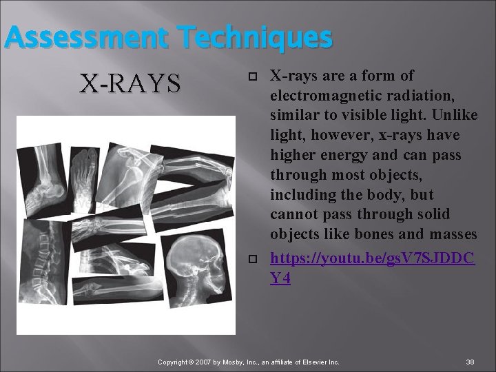 Assessment Techniques X-RAYS X-rays are a form of electromagnetic radiation, similar to visible light.