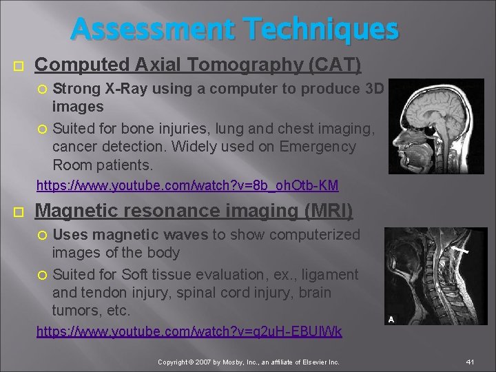 Assessment Techniques Computed Axial Tomography (CAT) Strong X-Ray using a computer to produce 3