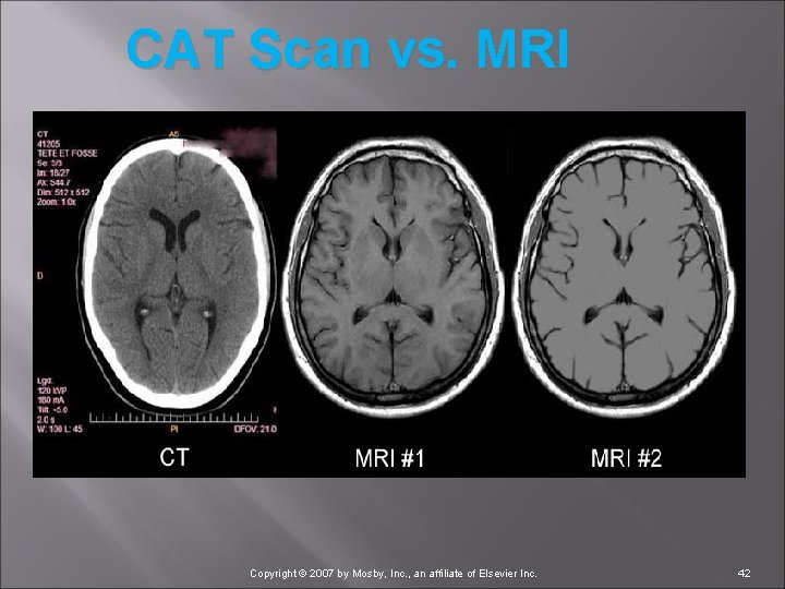 CAT Scan vs. MRI Copyright © 2007 by Mosby, Inc. , an affiliate of
