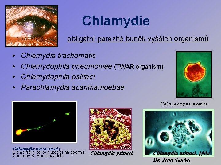 Chlamydie obligátní parazité buněk vyšších organismů • • Chlamydia trachomatis Chlamydophila pneumoniae (TWAR organism)