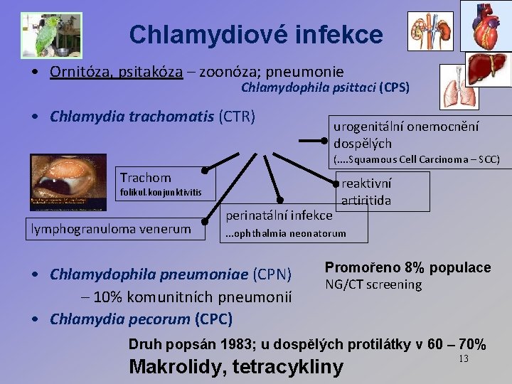 Chlamydiové infekce • Ornitóza, psitakóza – zoonóza; pneumonie Chlamydophila psittaci (CPS) • Chlamydia trachomatis