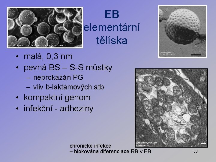 EB elementární tělíska • malá, 0, 3 nm • pevná BS – S-S můstky