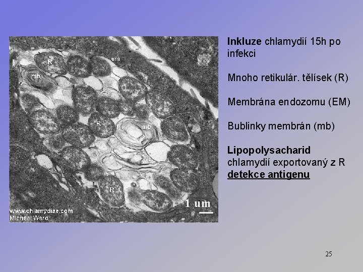 Inkluze chlamydií 15 h po infekci Mnoho retikulár. tělísek (R) Membrána endozomu (EM) Bublinky