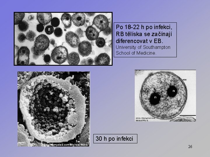 Po 18 -22 h po infekci, RB tělíska se začínají diferencovat v EB. University