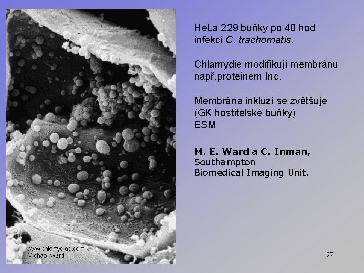 He. La 229 buňky po 40 hod infekci C. trachomatis. Chlamydie modifikují membránu např.