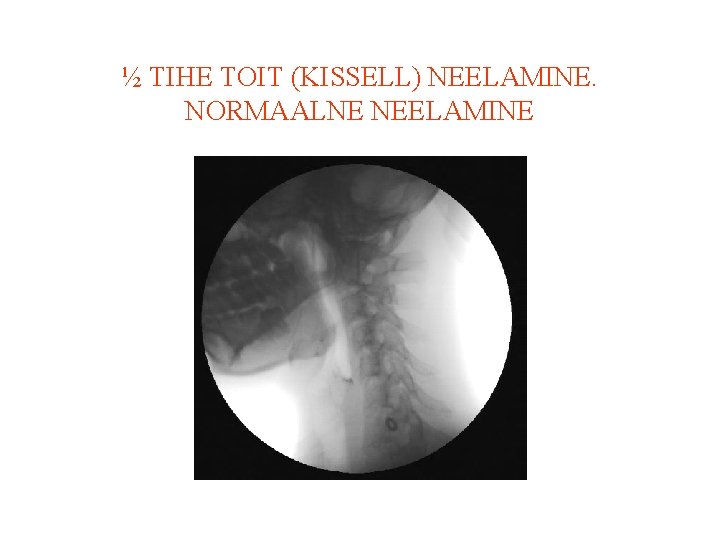 ½ TIHE TOIT (KISSELL) NEELAMINE. NORMAALNE NEELAMINE 