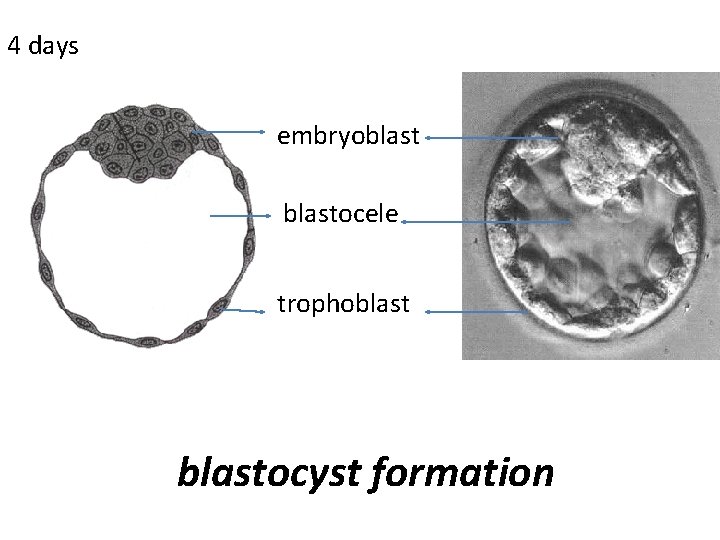 4 days embryoblastocele trophoblastocyst formation 