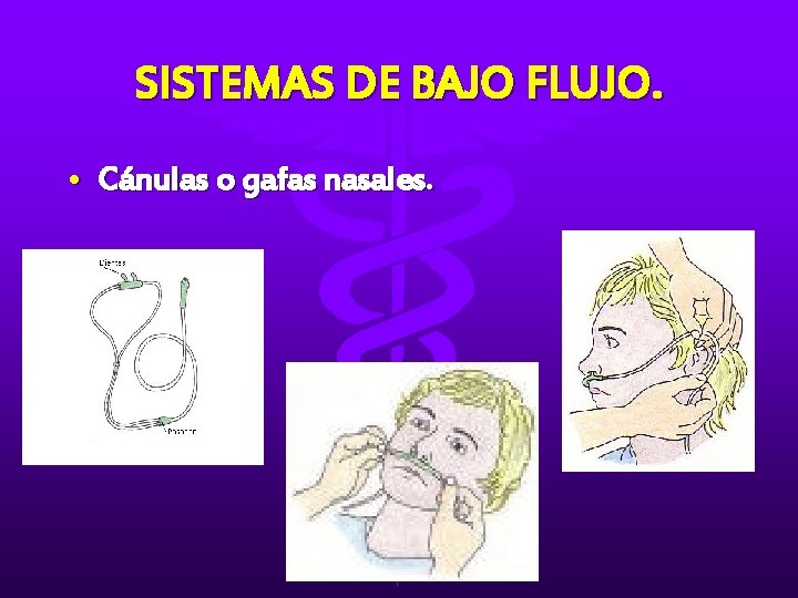 SISTEMAS DE BAJO FLUJO. • Cánulas o gafas nasales. 