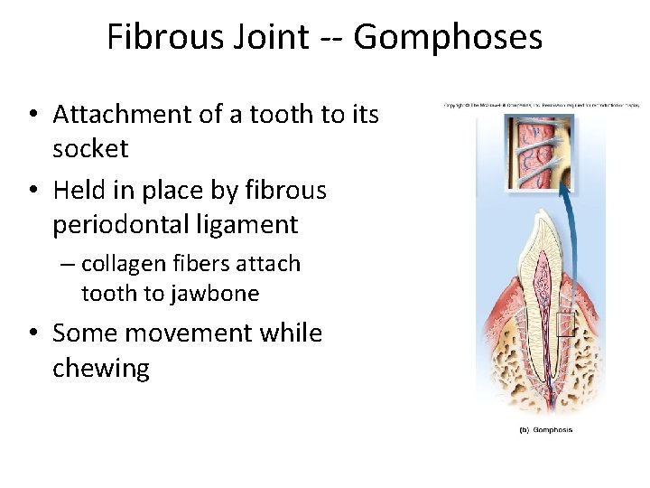 Fibrous Joint -- Gomphoses • Attachment of a tooth to its socket • Held Fibrous Joint -- Gomphoses • Attachment of a tooth to its socket • Held