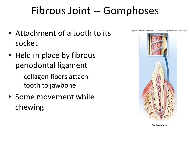 Fibrous Joint -- Gomphoses • Attachment of a tooth to its socket • Held