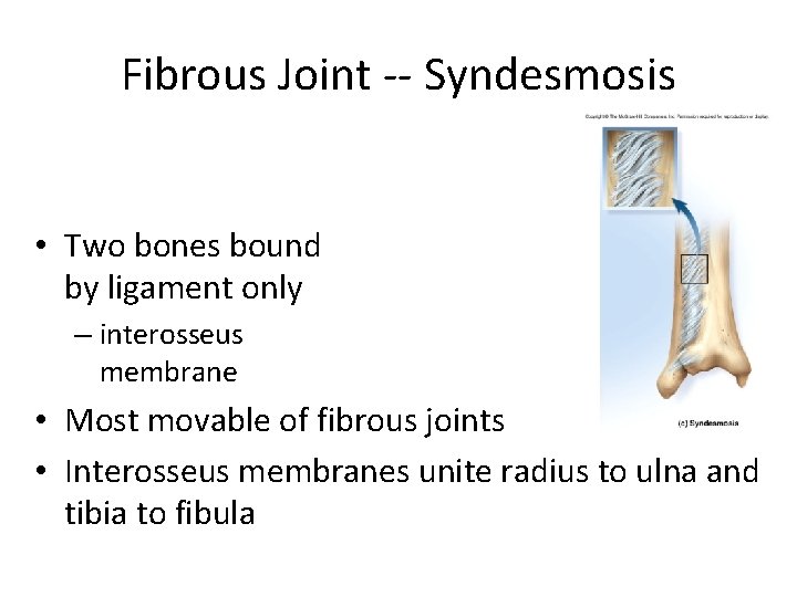 Fibrous Joint -- Syndesmosis • Two bones bound by ligament only – interosseus membrane