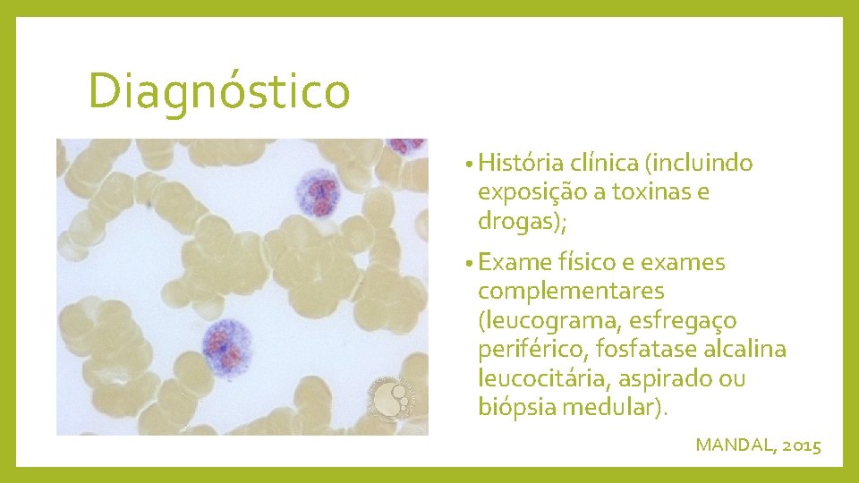 Diagnóstico • História clínica (incluindo exposição a toxinas e drogas); • Exame físico e