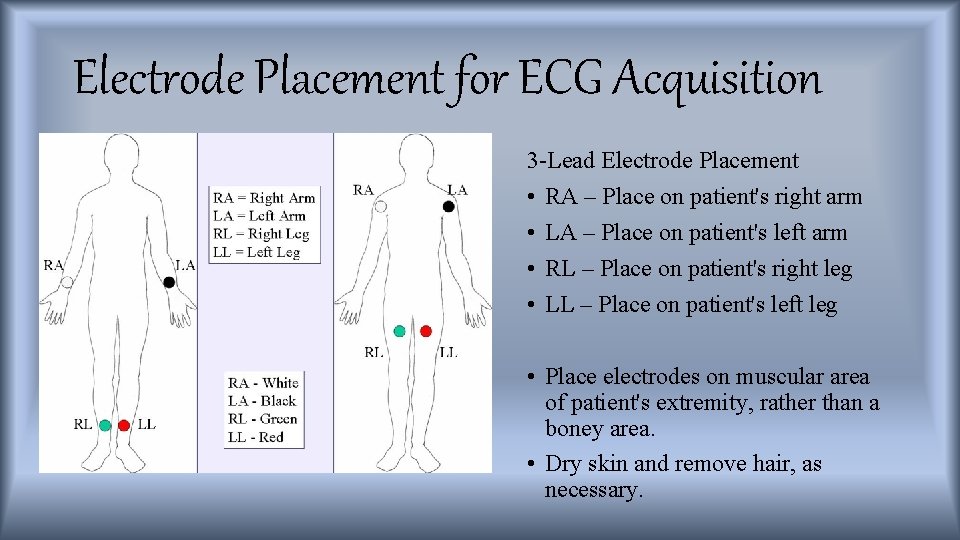 Electrode Placement for ECG Acquisition 3 -Lead Electrode Placement • RA – Place on