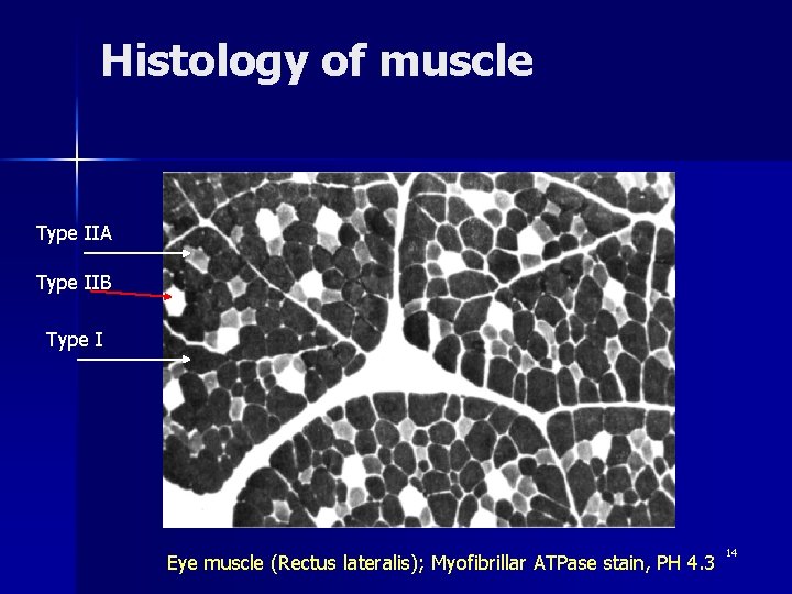 Histology of muscle Type IIA Type IIB Type I Eye muscle (Rectus lateralis); Myofibrillar