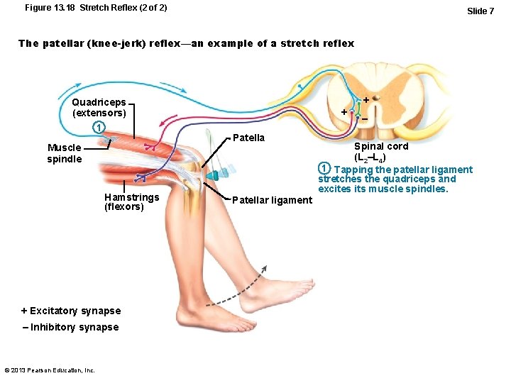 Figure 13. 18 Stretch Reflex (2 of 2) Slide 7 The patellar (knee-jerk) reflex—an