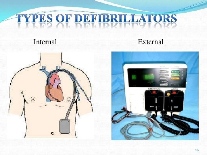 Defibrillator 