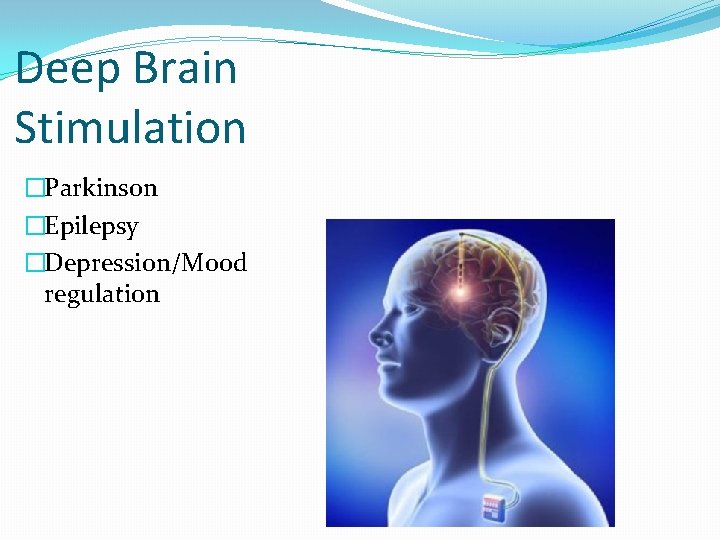 Deep Brain Stimulation �Parkinson �Epilepsy �Depression/Mood regulation 