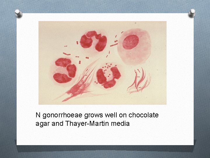 N gonorrhoeae grows well on chocolate agar and Thayer-Martin media 