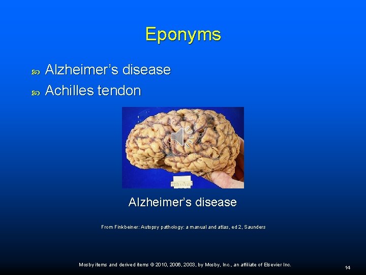 Eponyms Alzheimer’s disease Achilles tendon Alzheimer’s disease From Finkbeiner: Autopsy pathology: a manual and