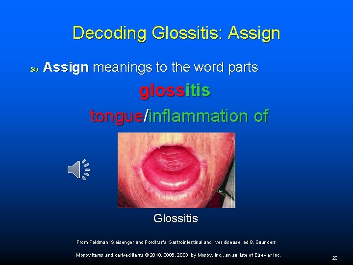 Decoding Glossitis: Assign meanings to the word parts glossitis tongue/inflammation of Glossitis From Feldman: