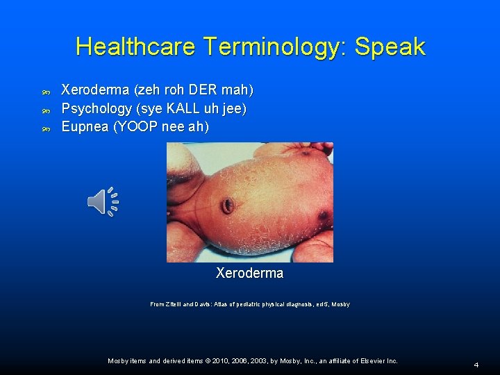 Healthcare Terminology: Speak Xeroderma (zeh roh DER mah) Psychology (sye KALL uh jee) Eupnea