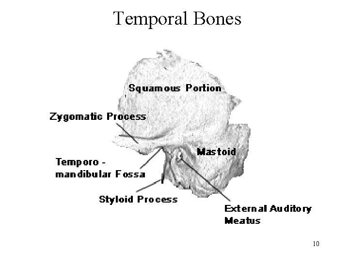 Temporal Bones 10 