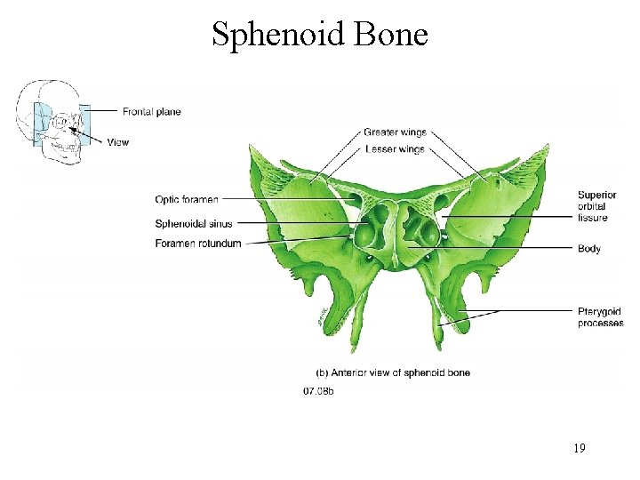 Sphenoid Bone 19 