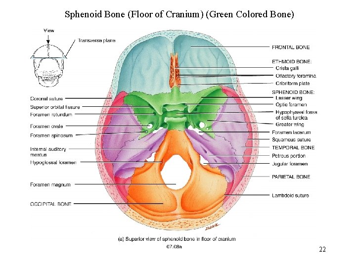Sphenoid Bone (Floor of Cranium) (Green Colored Bone) 22 