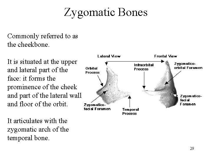 Zygomatic Bones Commonly referred to as the cheekbone. It is situated at the upper