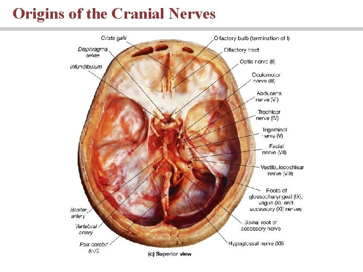 Origins of the Cranial Nerves PLAY 