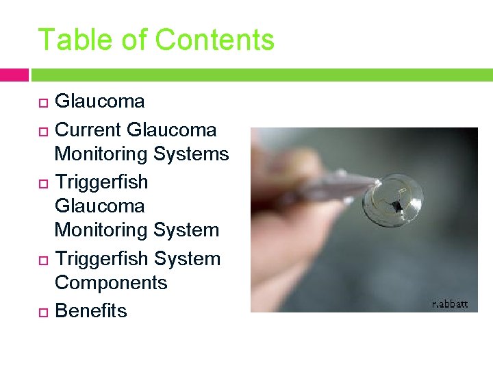 Table of Contents Glaucoma Current Glaucoma Monitoring Systems Triggerfish Glaucoma Monitoring System Triggerfish System