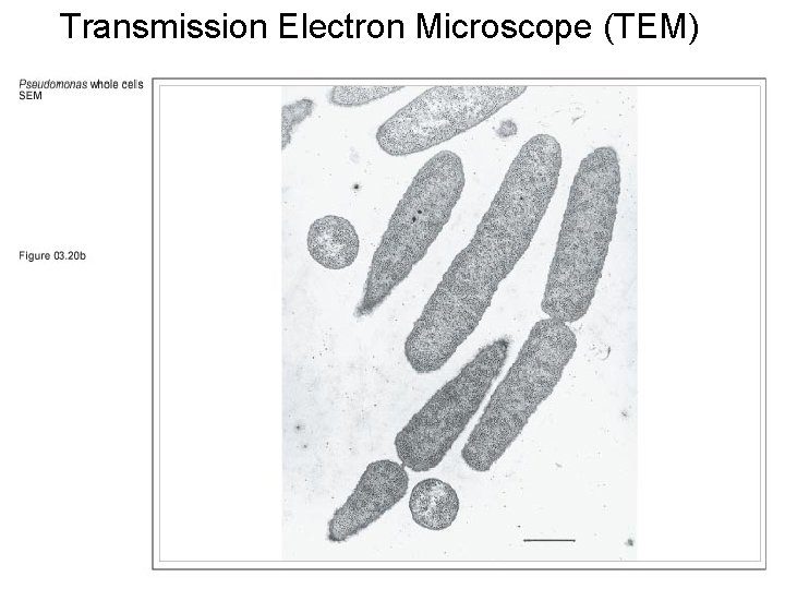 Transmission Electron Microscope (TEM) 