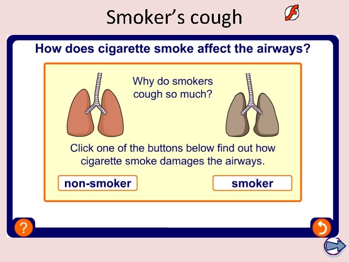 Smoker’s cough 