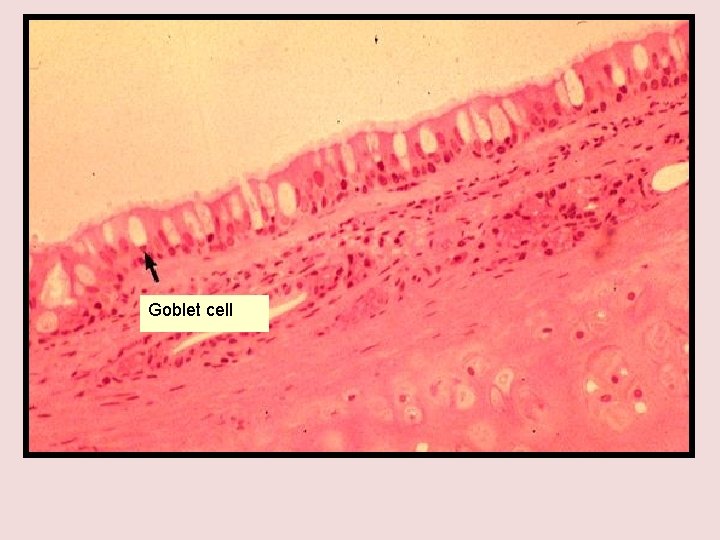 Goblet cell 