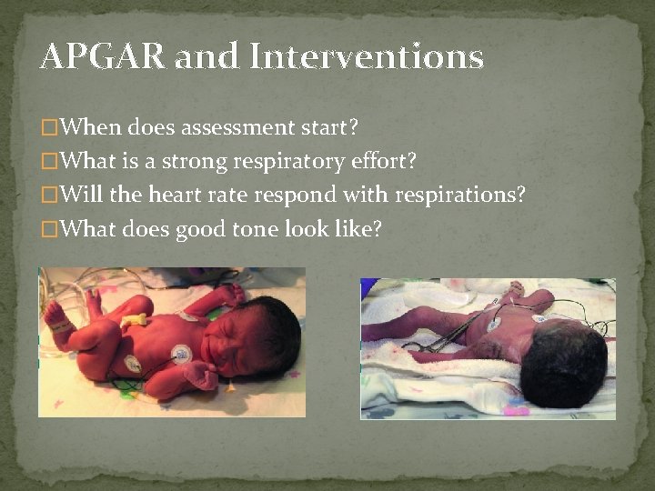 APGAR and Interventions �When does assessment start? �What is a strong respiratory effort? �Will