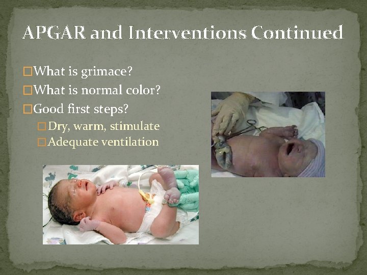 APGAR and Interventions Continued �What is grimace? �What is normal color? �Good first steps?