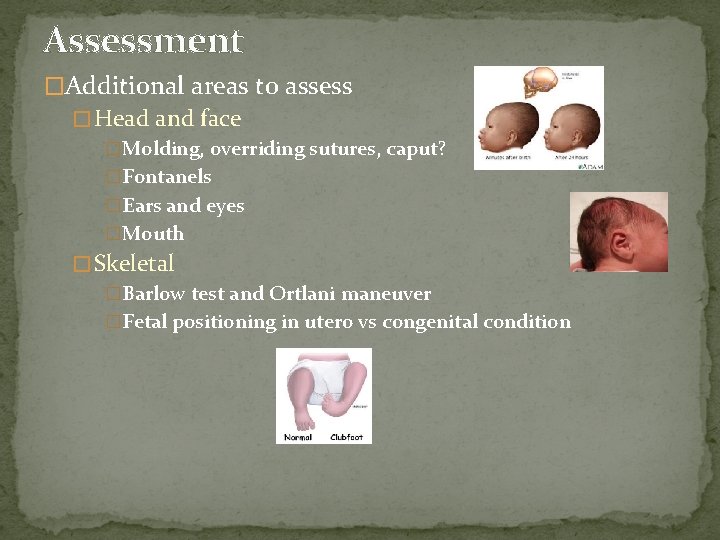 Assessment �Additional areas to assess � Head and face �Molding, overriding sutures, caput? �Fontanels
