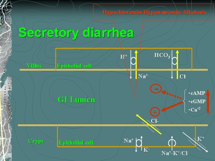 Hypochloremia/Hyponatremia/Alkalosis Secretory diarrhea HCO 3 - H+ Villus Epithelial cell Na+ Cl- - •