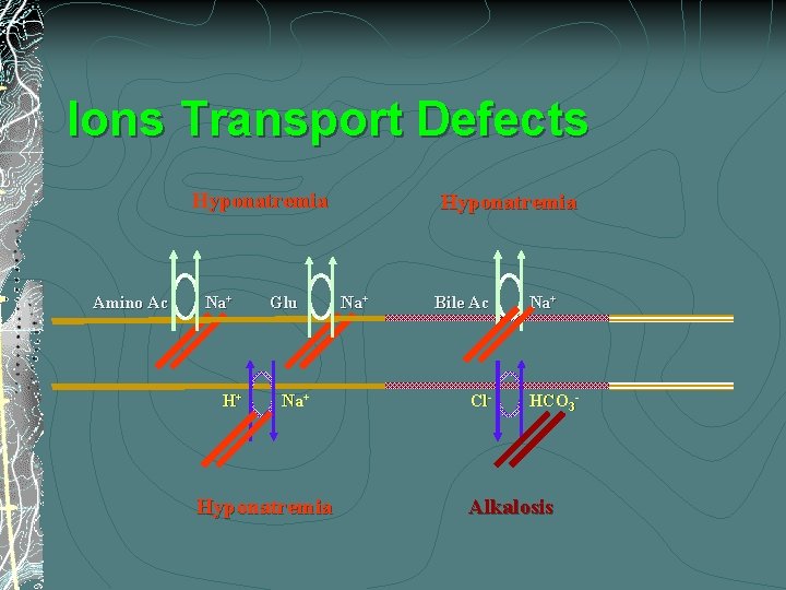 Ions Transport Defects Hyponatremia Amino Ac Na+ H+ Glu Na+ Hyponatremia Na+ Bile Ac