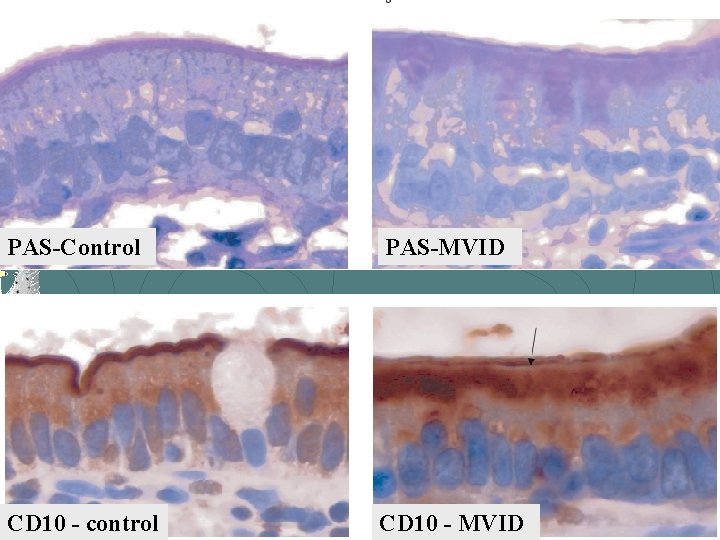 PAS-Control PAS-MVID CD 10 - control CD 10 - MVID 