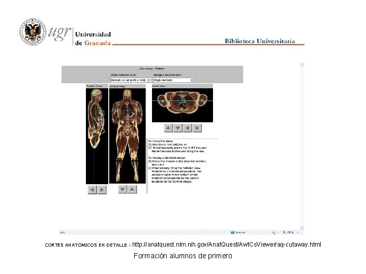 CORTES ANATÓMICOS EN DETALLE : http: //anatquest. nlm. nih. gov/Anat. Quest/Awt. Cs. Viewer/aq-cutaway. html