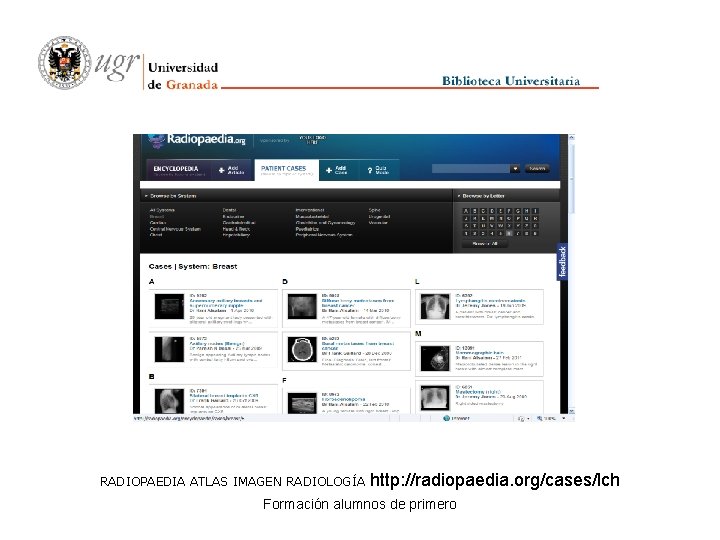 RADIOPAEDIA ATLAS IMAGEN RADIOLOGÍA http: //radiopaedia. org/cases/lch Formación alumnos de primero 