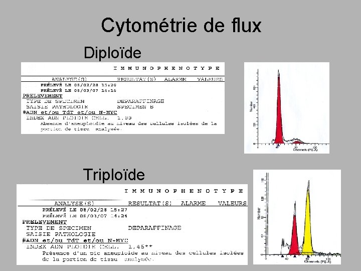 Cytométrie de flux Diploïde Triploïde 