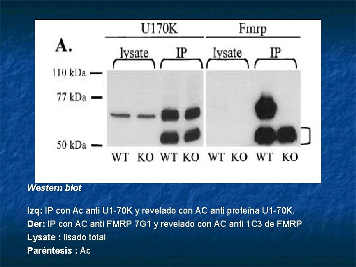 Western blot Izq: IP con Ac anti U 1 -70 K y revelado con