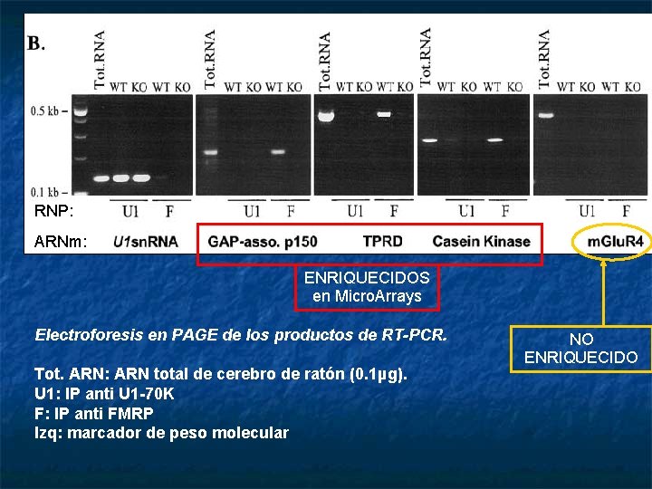 RNP: ARNm: ENRIQUECIDOS en Micro. Arrays Electroforesis en PAGE de los productos de RT-PCR.