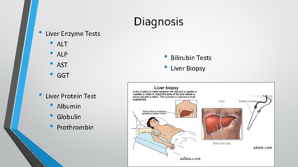  • • Diagnosis Liver Enzyme Tests • ALT • ALP • AST •