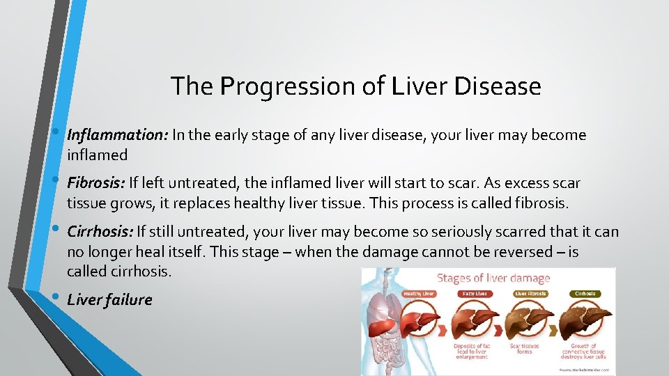 The Progression of Liver Disease • Inflammation: In the early stage of any liver