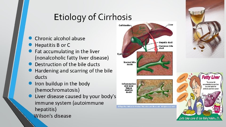 Etiology of Cirrhosis Chronic alcohol abuse Hepatitis B or C Fat accumulating in the