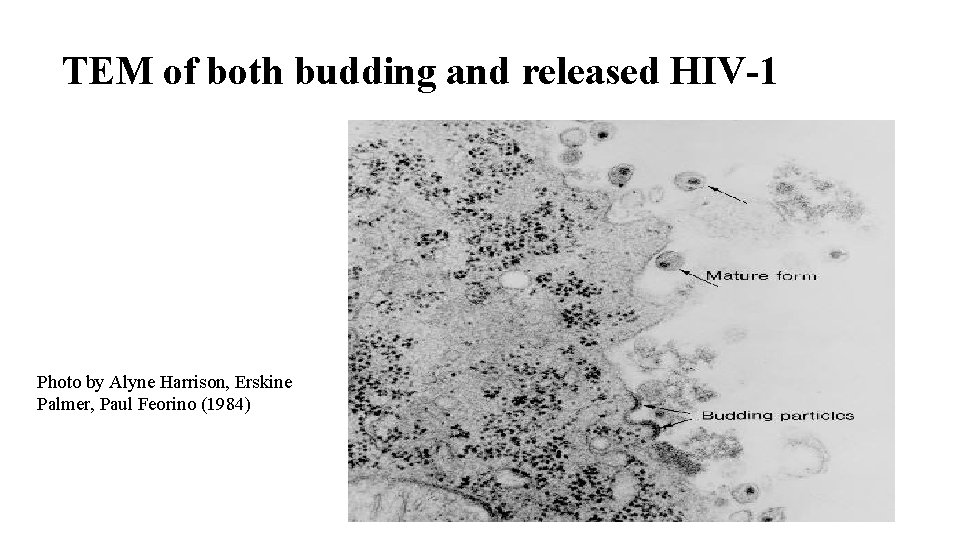 TEM of both budding and released HIV-1 Photo by Alyne Harrison, Erskine Palmer, Paul