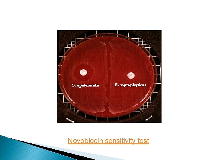 Novobiocin sensitivity test 
